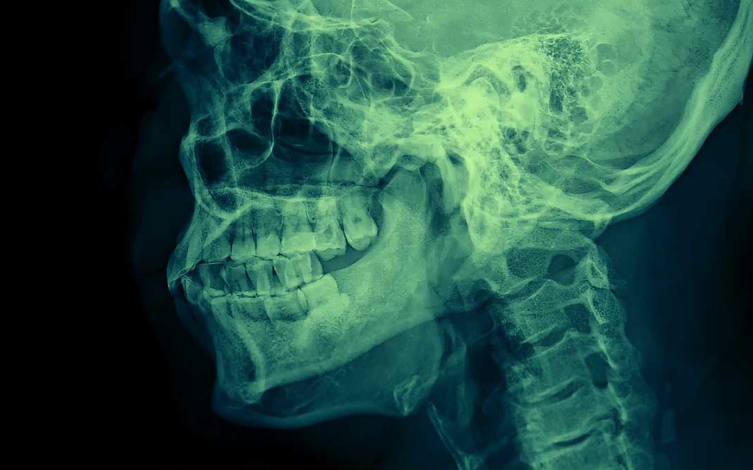 Craniomandibuläre Dysfunktion (CMD): Ein tiefgehender Blick in die komplexe Erkrankung des Kauorgans